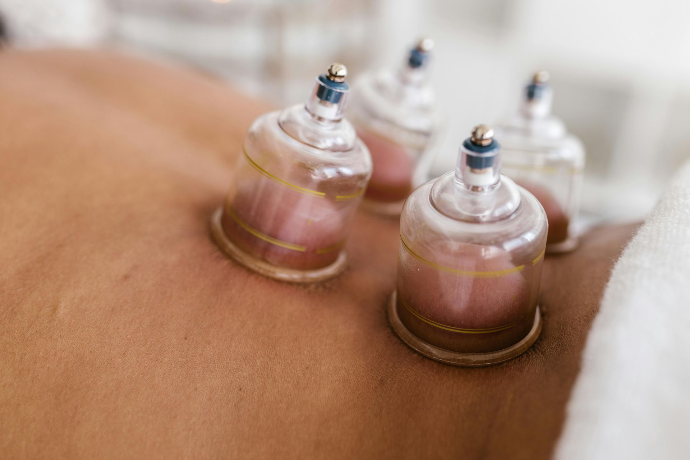 Cupping therapie